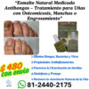 “Esmalte Natural Medicado Antihongos – Tratamiento para Uñas con Onicomicosis, Manchas o Engrosamiento”  "Envío GRATIS en el 90% de México."