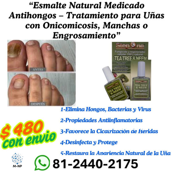 “Esmalte Natural Medicado Antihongos – Tratamiento para Uñas con Onicomicosis, Manchas o Engrosamiento”  "Envío GRATIS en el 90% de México."